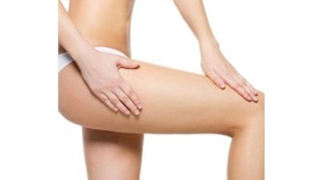 Cellulite got you Bothered? Battle it with a Thigh Lift!