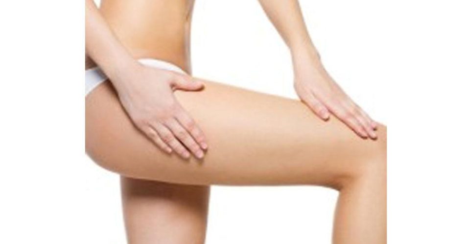 Cellulite got you Bothered? Battle it with a Thigh Lift!