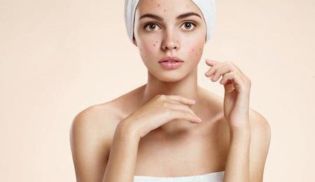 How to Treat Your Acne with Medical Skin Care