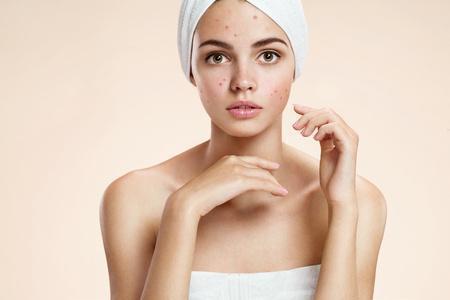 How to Treat Your Acne with Medical Skin Care