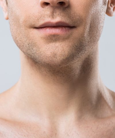 Minimally Invasive Neck Lift Surgery