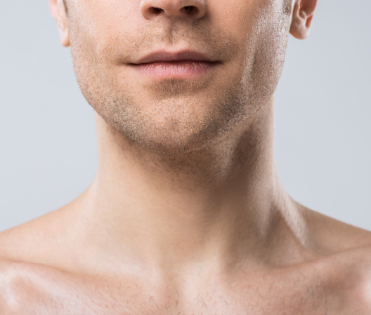 Minimally Invasive Neck Lift Surgery