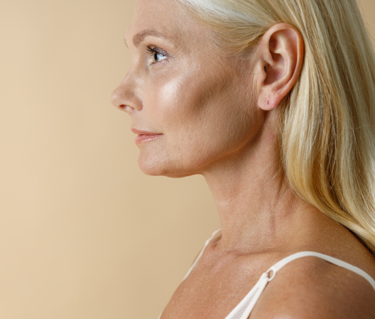 Benefits of Choosing the Lateral Brow Lift with Your V-Lift