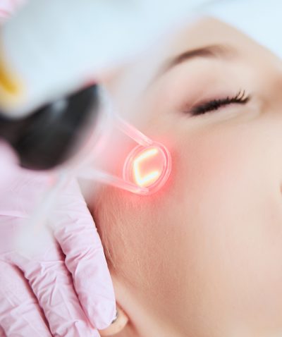 Laser Resurfacing